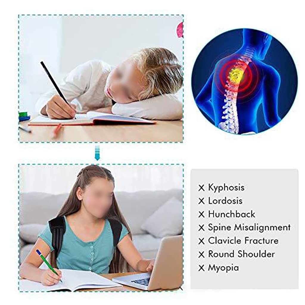 Adjustable Clavicle & Upper Back Support Brace
