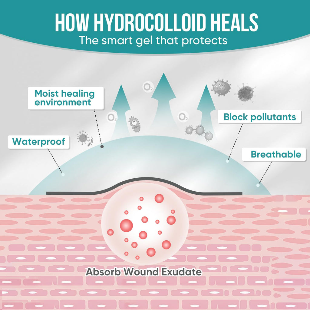 Hydrocolloid Roll for Wound Dressings