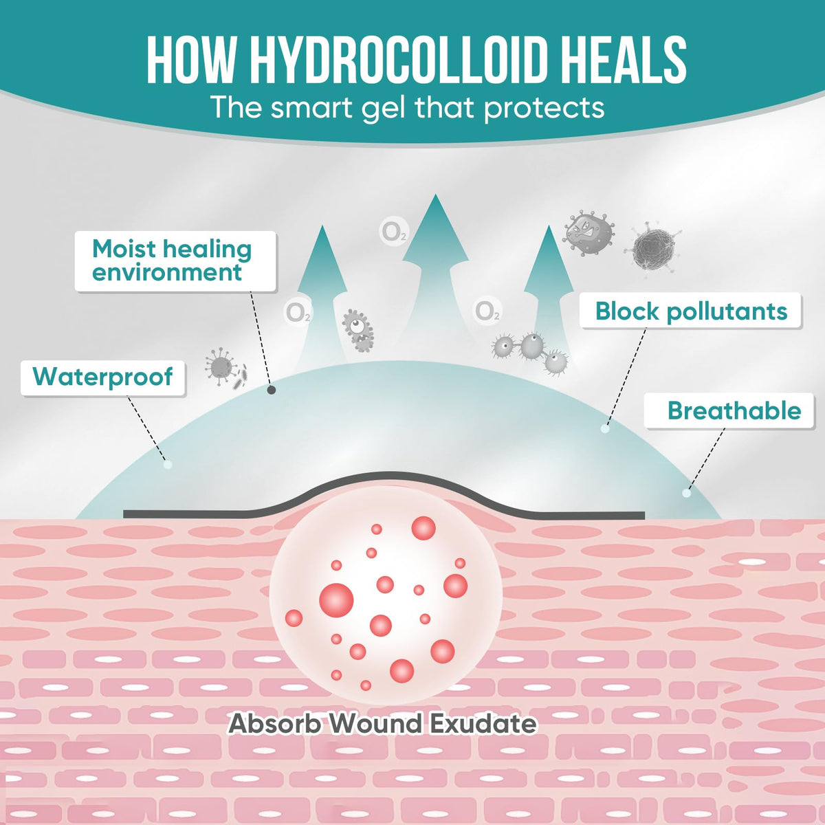 Hydrocolloid Roll for Wound Dressings
