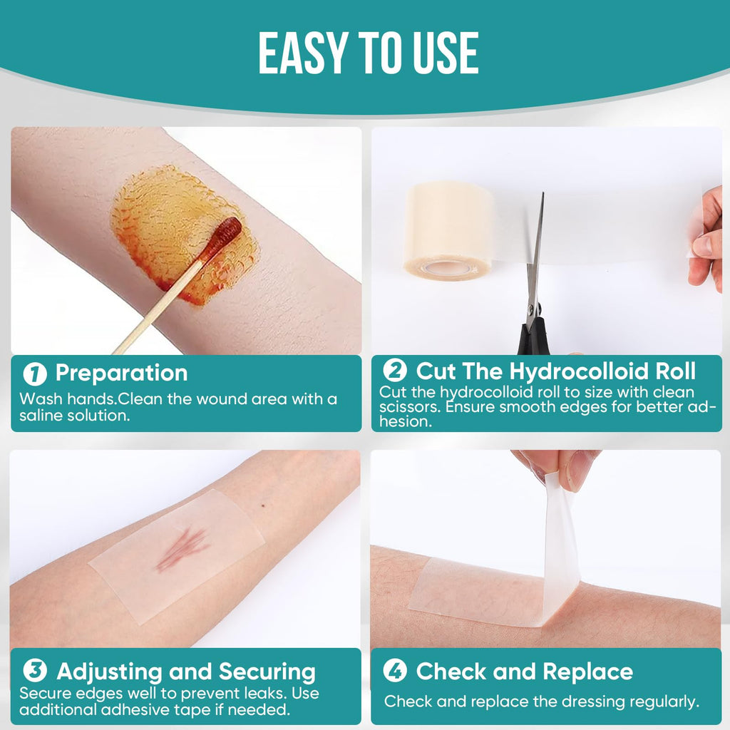 Hydrocolloid Roll for Wound Dressings