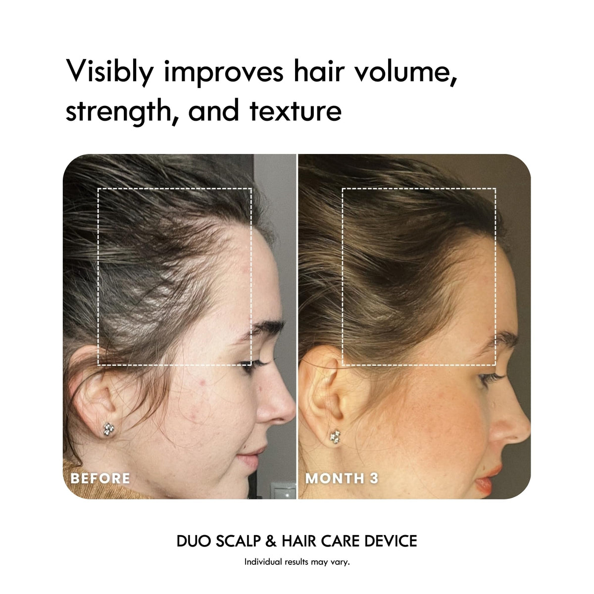 4-in-1 Warming Scalp Massage & Hair Care Device