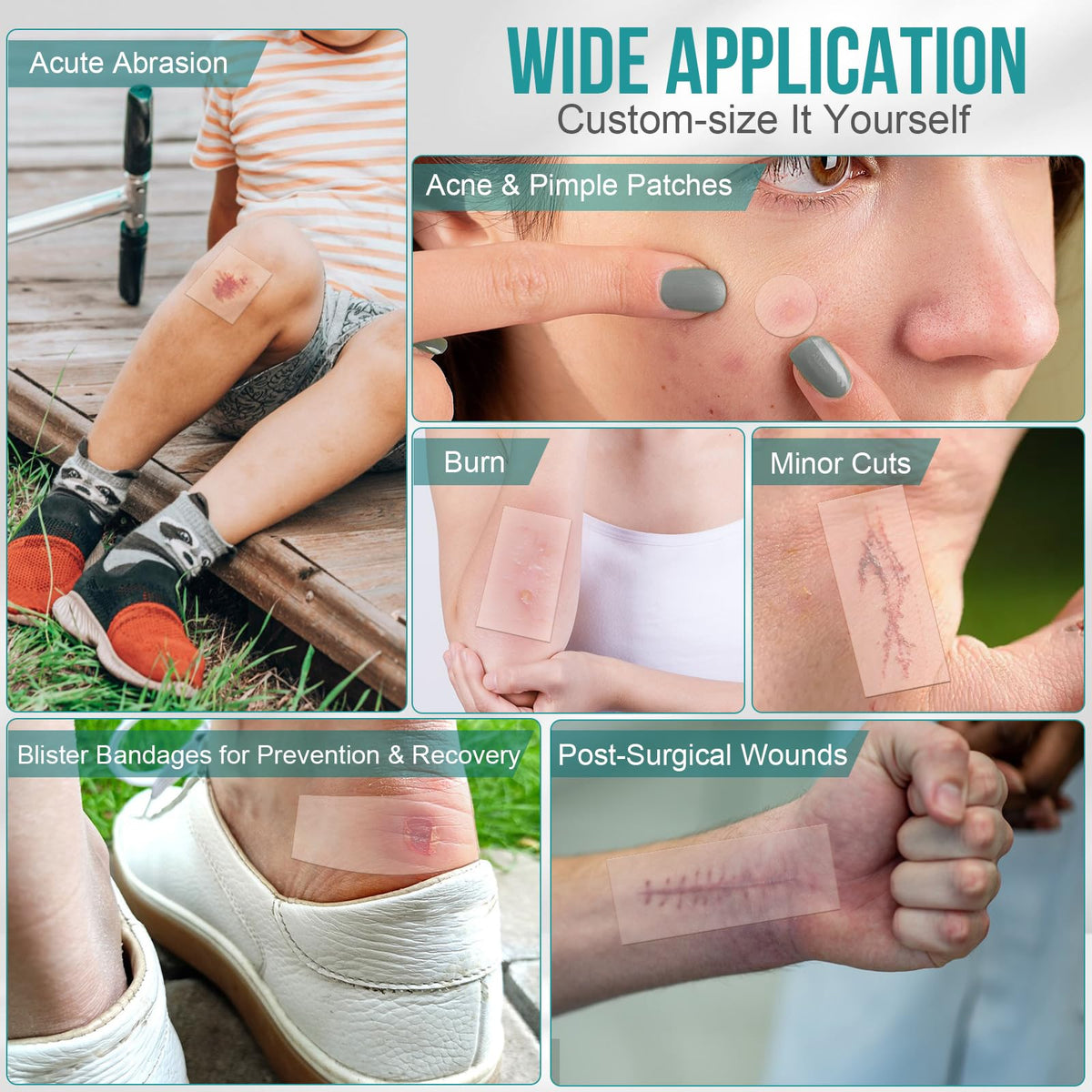 Hydrocolloid Roll for Wound Dressings